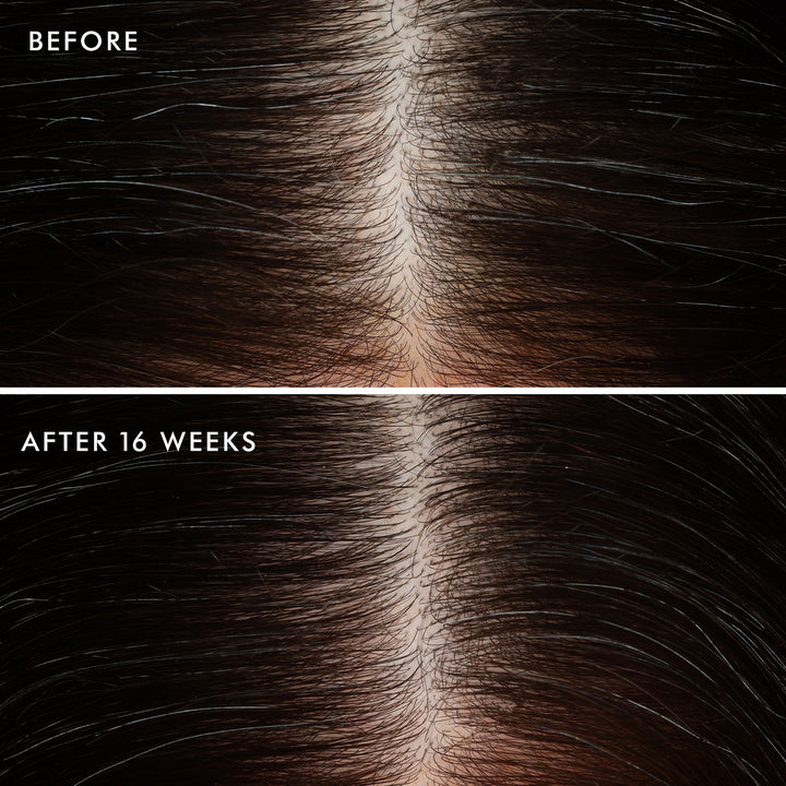 MOROCCANOIL Scalp Revitalizing Scalp Tonic 100 ml